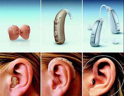 Hearing aids vary widely
