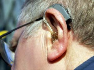 Read more about the article Loss of hearing can cause dementia?
