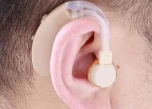 Read more about the article Advantages of wearing a hearing aid with both ears