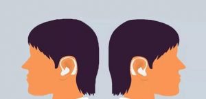 Read more about the article What should I do if I find myself suffering from hearing loss?