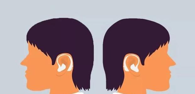 Deafness, hearing loss