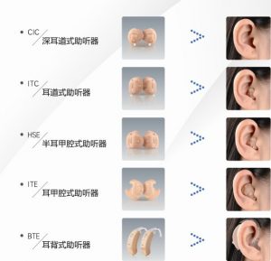 Read more about the article The wearing effect of the customized hearing aid is as follows