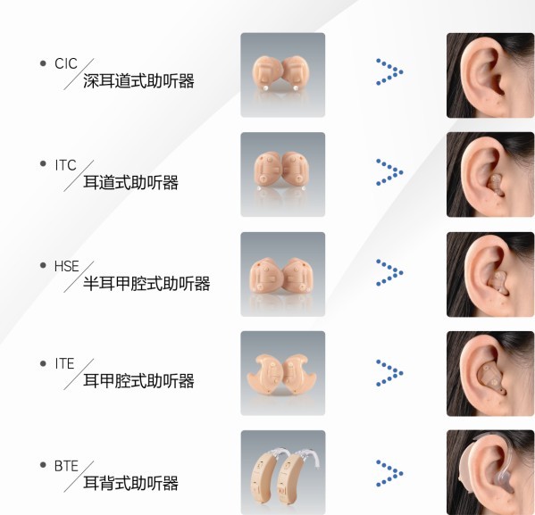 You are currently viewing The wearing effect of the customized hearing aid is as follows