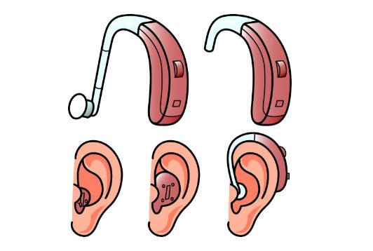 Factors affecting the sound effects of hearing aids