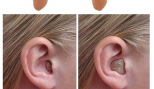 Read more about the article Ear pain when wearing a hearing aid