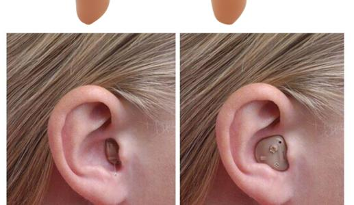 You are currently viewing Ear pain when wearing a hearing aid