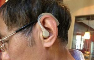 Read more about the article Hearing aid is very stuffy