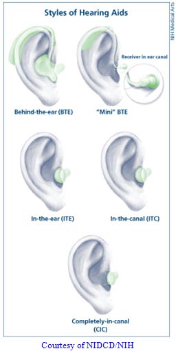 Styles of hearing aids. Depicts behind the ear, mini BTE, in-the-ear ITE, in-the-canal ITC, and completely-in-canal CIC. Courtesy of NIDCD/NIH