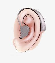 Read more about the article Can the hearing aid be worn with both ears?