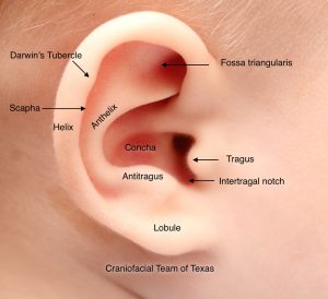 Read more about the article The causes of hearing loss in children