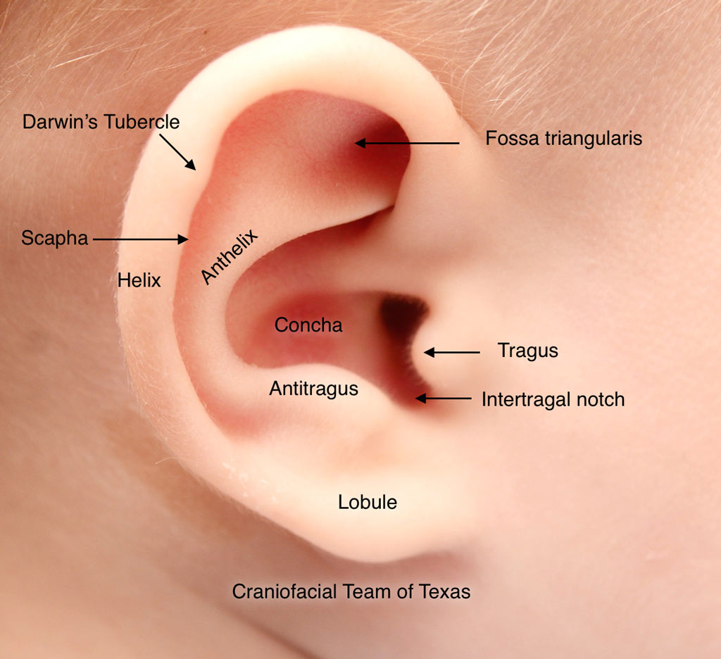 You are currently viewing The causes of hearing loss in children