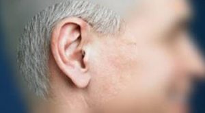 Read more about the article Can the hearing aid cure the deafness?