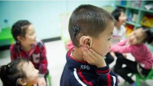 Read more about the article Three kinds of rehabilitation training methods for deafness