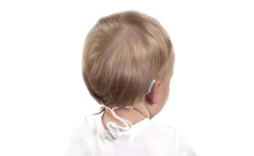 You are currently viewing Frequently asked questions about children wearing hearing aids
